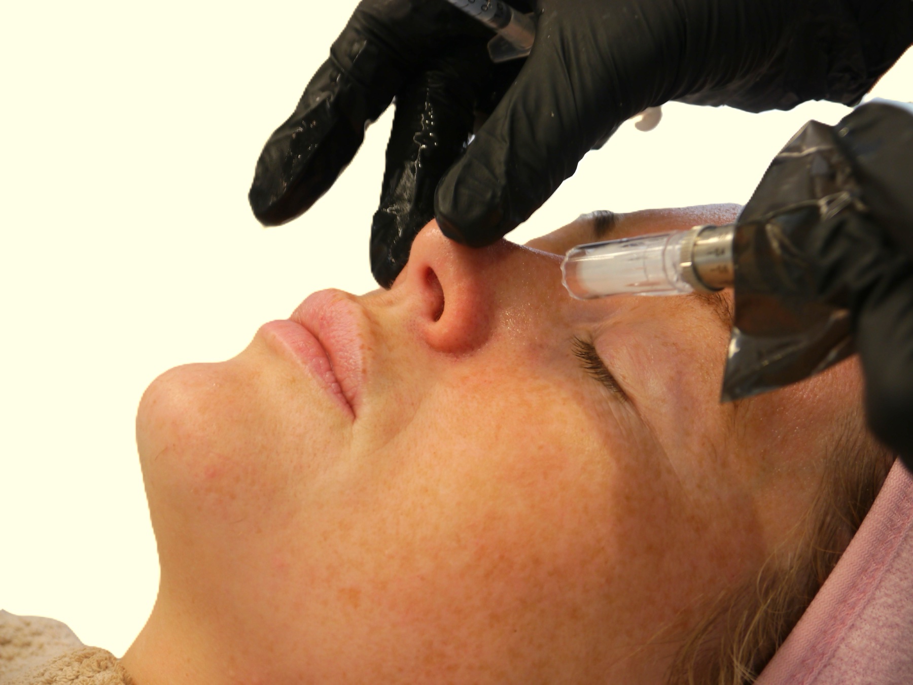 Anti-wrinkle injection treatment